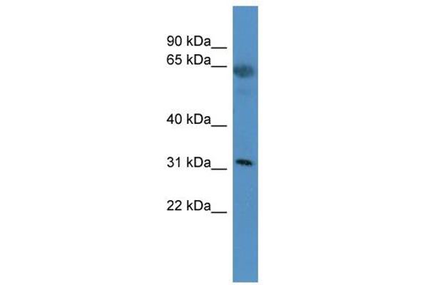 OR2T29 antibody  (C-Term)