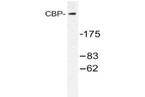 Western blot (WB) analysis of CBP antibody in extracts from HT-29 cells treated with calyculinA 50ng. (CBP antibody)