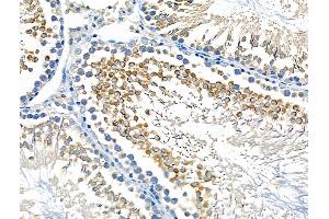 ABIN6259306 and ABIN6275529 at 1/100 staining Rat testis tissue by IHC-P.
