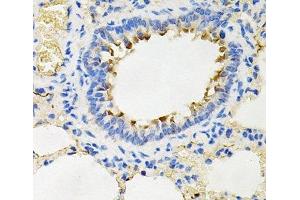 Immunohistochemistry of paraffin-embedded Rat lung using IRAK2 Polyclonal Antibody at dilution of 1:100 (40x lens). (IRAK2 antibody)