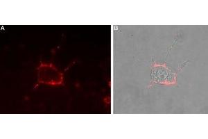 Immunocytochemistry (ICC) image for anti-Calcium Channel, Voltage-Dependent, L Type, alpha 1D Subunit (CACNA1D) (AA 215-227), (Extracellular) antibody (ABIN7043002)