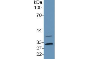 Detection of C1QBP in Human Hela cell lysate using Monoclonal Antibody to Complement component 1 Q subcomponent-binding protein, mitochondrial (C1QBP) (C1QBP antibody  (AA 76-282))