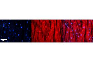 Rabbit Anti-TXN Antibody Catalog Number: ARP72618_P050 Formalin Fixed Paraffin Embedded Tissue: Human heart Tissue Observed Staining: Cytoplasmic near intercalated discs Primary Antibody Concentration: 1:100 Other Working Concentrations: N/A Secondary Antibody: Donkey anti-Rabbit-Cy3 Secondary Antibody Concentration: 1:200 Magnification: 20X Exposure Time: 0. (TXN antibody  (C-Term))