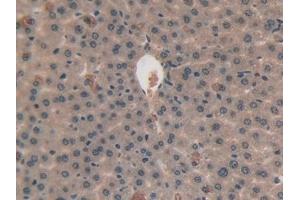 Detection of VEGFC in Mouse Liver Tissue using Polyclonal Antibody to Vascular Endothelial Growth Factor C (VEGFC) (VEGFC antibody  (AA 108-223))