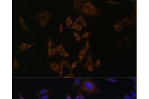 Immunofluorescence analysis of HeLa cells using UBE2L6 Polyclonal Antibody at dilution of 1:100. (UBE2L6 antibody)