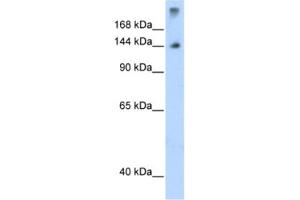 Western Blotting (WB) image for anti-Splicing Factor 3b, Subunit 1, 155kDa (SF3B1) antibody (ABIN2462069)
