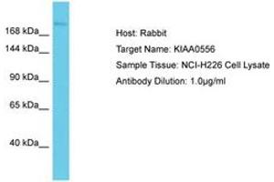 Image no. 1 for anti-KIAA0556 (KIAA0556) (AA 142-191) antibody (ABIN6750570)