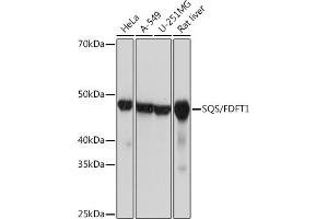 Western blot analysis of extracts of various cell lines, using SQS/FDFT1 Rabbit mAb (ABIN7267130) at 1:1000 dilution.