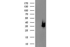 HEK293T cells were transfected with the pCMV6-ENTRY control (Left lane) or pCMV6-ENTRY DCK (Right lane) cDNA for 48 hrs and lysed. (DCK antibody)