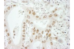 anti-Superkiller Viralicidic Activity 2-Like 2 (SKIV2L2) (AA 100-150) antibody