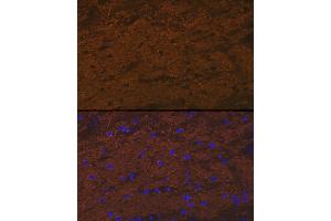 Immunofluorescence analysis of rat brain cells using TMOD2 Rabbit mAb (ABIN7271011) at dilution of 1:100 (40x lens). (TMOD2 antibody)