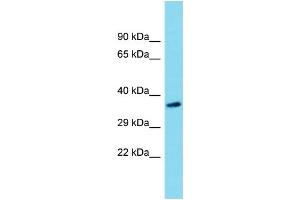 Western Blotting (WB) image for anti-Sideroflexin 5 (SFXN5) (N-Term) antibody (ABIN2774474) (Sideroflexin 5 antibody  (N-Term))