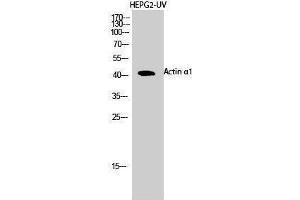 Western Blotting (WB) image for anti-Actin, alpha 1, Skeletal Muscle (ACTA1) (N-Term) antibody (ABIN3173662) (Actin antibody  (N-Term))