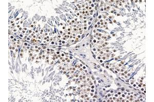ABIN6258757 and ABIN6275019 at 1/100 staining rat testis tissue by IHC-P.