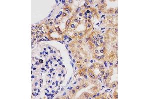 (ABIN6243842 and ABIN6577230) staining GLS2 in human kidney tissue sections by Immunohistochemistry (IHC-P - paraformaldehyde-fixed, paraffin-embedded sections).