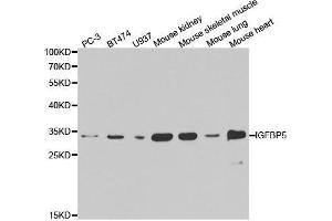 Western blot analysis of extracts of various cell lines, using IGFBP5 antibody. (IGFBP5 antibody  (AA 21-272))