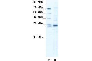 Human Jurkat; WB Suggested Anti-SOX12 Antibody. (SOX12 antibody  (C-Term))