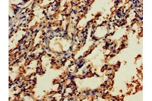 Immunohistochemistry of paraffin-embedded human lung tissue using ABIN7161677 at dilution of 1:100 (NOG antibody  (AA 28-232))