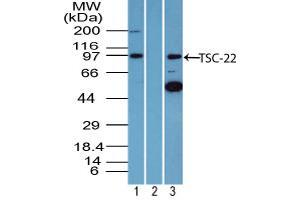 Image no. 1 for anti-TSC22 Domain Family, Member 1 (TSC22D1) (AA 100-150) antibody (ABIN960389) (TSC22D1 antibody  (AA 100-150))