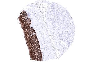 Tonsil surface Epithelium A strong KRT15 immunostaining is found in all cell layers of all non keratinizing and keratinizing squamous epithelium except keratin layer (KRT15 antibody)