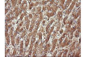 Image no. 1 for anti-Cancer/testis Antigen 1B (CTAG1B) antibody (ABIN1499897) (CTAG1B antibody)
