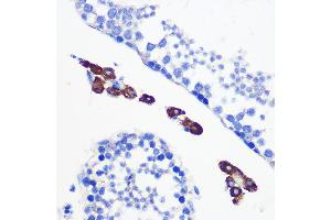 Immunohistochemistry of paraffin-embedded mouse testis using [KO Validated] Bax Rabbit mAb (ABIN7265855) at dilution of 1:100 (40x lens).