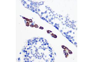 Immunohistochemistry of paraffin-embedded mouse testis using [KO Validated] Bax Rabbit mAb (ABIN7265855) at dilution of 1:100 (40x lens). (BAX antibody)