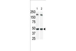 The anti-SphK1 Pab (ABIN391345 and ABIN2841366) is used in Western blot (Lane 2) to detect c-myc-tagged SphK1 in transfected 293 cell lysate (a c-myc antibody is used as control in Lane 1). (SPHK1 antibody  (N-Term))