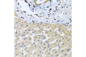 Immunohistochemistry of paraffin-embedded human liver injury using LETMD1 antibody (ABIN5971174) at dilution of 1/100 (40x lens). (LETMD1 antibody)