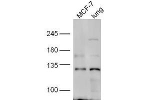 line1, MCF-7 lysate; line2,mouse lung lysate probed with Rabbit Anti-HNRPUL1 Polyclonal Antibody, Unconjugated  at 1:5000 for 90min at 37˚C. (HNRNPUL1 antibody  (AA 701-800))