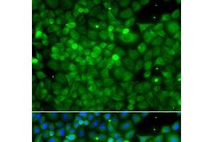 Immunofluorescence analysis of A549 cells using POC1A Polyclonal Antibody (POC1A antibody)