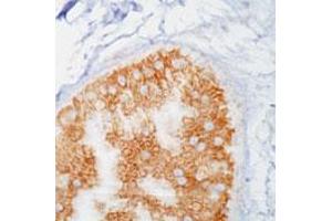 Immunohistochemistry (IHC) image for anti-Phosphotyrosine antibody (ABIN197635) (Phosphotyrosine antibody)