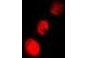 Immunofluorescent analysis of Cofilin 2 staining in A549 cells. (Cofilin 2 antibody)