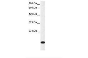 Image no. 1 for anti-Ribosomal Protein S16 (RPS16) (N-Term) antibody (ABIN202031) (RPS16 antibody  (N-Term))