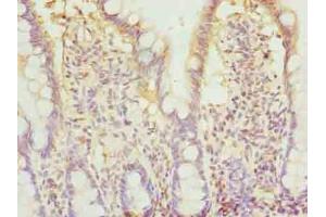 Immunohistochemistry of paraffin-embedded human small intestine tissue using ABIN7145881 at dilution of 1:100 (BTN2A2 antibody  (AA 33-262))