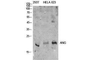 Western Blotting (WB) image for anti-Angiotensinogen (serpin Peptidase Inhibitor, Clade A, Member 8) (AGT) (Internal Region) antibody (ABIN3178889)
