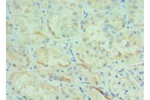 Immunohistochemistry of paraffin-embedded human kidney tissue using ABIN7145826 at dilution of 1:100