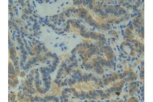 Immunohistochemistry (IHC) image for anti-P-Cadherin (CDH3) (AA 371-660) antibody (ABIN7437923)