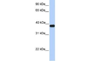 WB Suggested Anti-ASB5 Antibody Titration:  0.