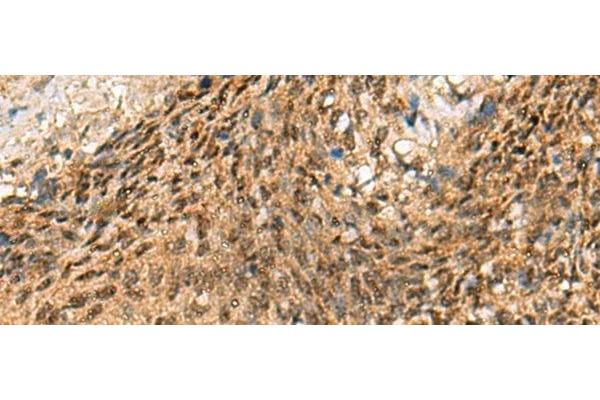 CRCP antibody