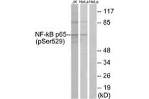 Western blot analysis of extracts from HeLa and Jurkat cells, using NF-kappaB p65 (Phospho-Ser529) Antibody. (NF-kB p65 antibody  (pSer529))