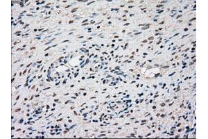 Immunohistochemical staining of paraffin-embedded Kidney tissue using anti-SSBmouse monoclonal antibody. (SSB antibody)