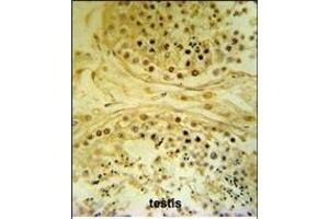 I Antibody (C-term) (ABIN653307 and ABIN2842806) IHC analysis in formalin fixed and paraffin embedded human testis carcinoma followed by peroxidase conjugation of the secondary antibody and DAB staining. (IMP4 antibody  (C-Term))