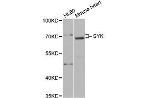 Western blot analysis of extracts of various cell lines, using SYK antibody (ABIN5971150) at 1/500 dilution. (SYK antibody)