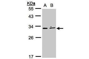 WB Image Sample (30μg whole cell lysate) A:MOLT4 , B:Raji , 12% SDS PAGE antibody diluted at 1:500 (XRCC2 antibody)