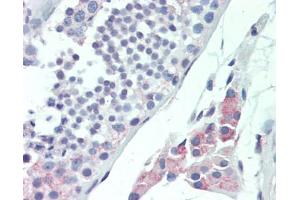Human Testis: Formalin-Fixed, Paraffin-Embedded (FFPE), at a dilution of 1:100. (MLF1 antibody  (AA 215-244))