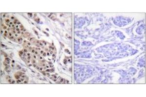 Immunohistochemistry (IHC) image for anti-Tumor Protein P53 (TP53) (AA 344-393), (pSer392) antibody (ABIN1531357)