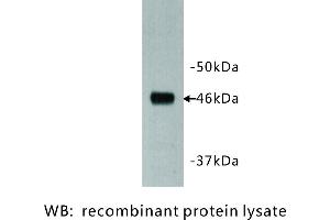 Image no. 1 for anti-Dachsous 1 (DCHS1) antibody (ABIN1112924) (DCHS1 antibody)