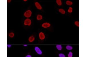 Confocal immunofluorescence analysis of U2OS cells using KU70 Polyclonal Antibody at dilution of 1:100. (XRCC6 antibody)