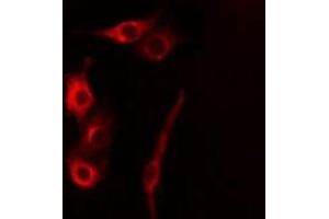 ABIN6277853 staining HeLa cells by IF/ICC. (CASP5 antibody)